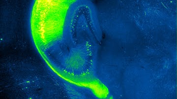 Hippocampus region crop of a cleared mouse brain