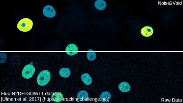 Noise2Void - Learning Denoising from Single Noisy Images