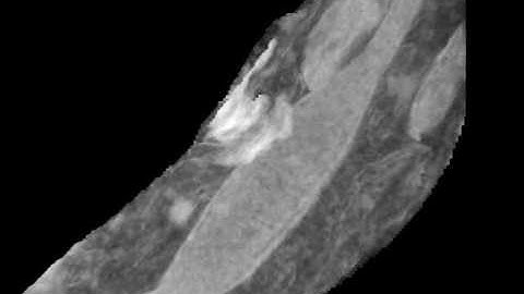 Animated 3D reconstruction of mitochondrial structure in hippocampal tissue of APP/PS1 mouse