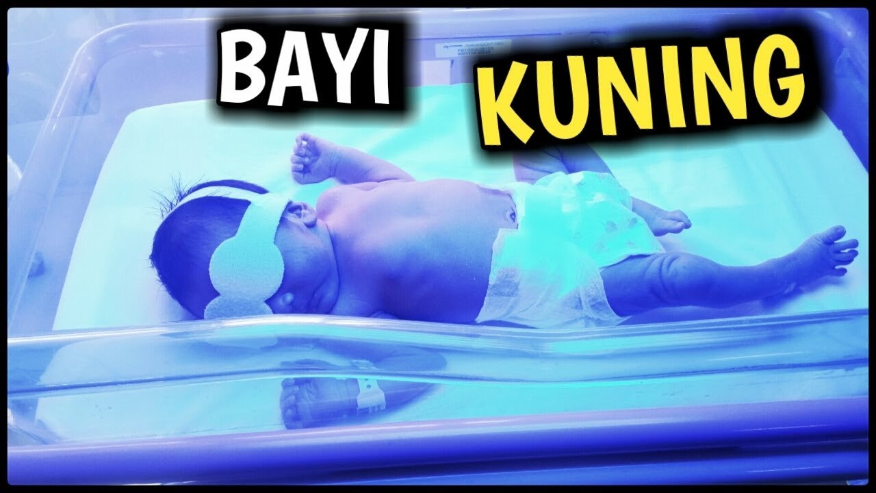 Cara Mengatasi BAYI KUNING - Fototerapi Bayi Disinar Biru