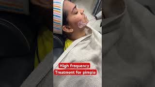 High frequency treatment for pimple 💕