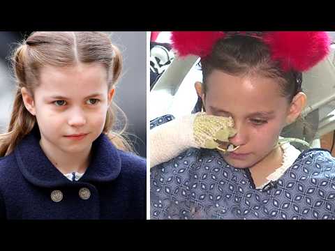 Princess Charlotte Surprised a BURNED 8-Year-Old… What He Said BROKE Everyone