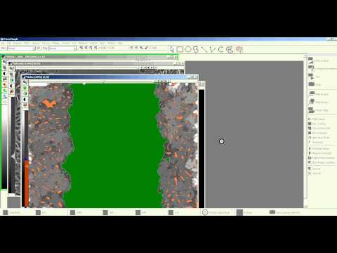 Wound heal measure.AVI