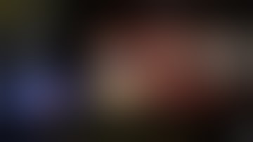 Laparoscopic Hepatectomy Utilizing Fluorescence Imaging for Identification of Hepatic Tumors