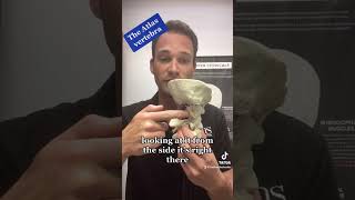 The Atlas Vertebra C1