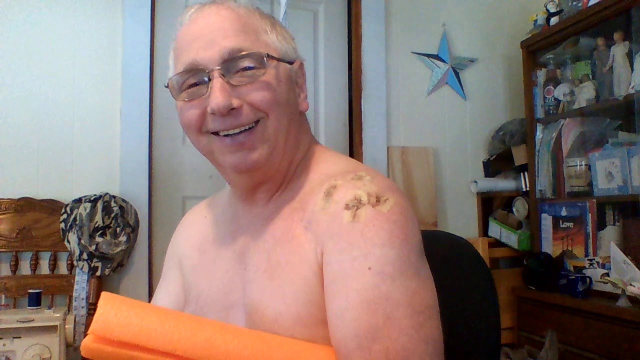 Rotator Cuff Surgery Day 3 YouTube