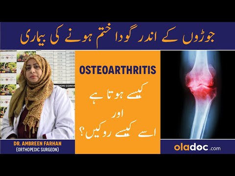How To Treat Degenerative Joint Disease - Joron Men Dard - Osteoarthritis Ki Wajah Aur Ilaj In Urdu thumbnail image