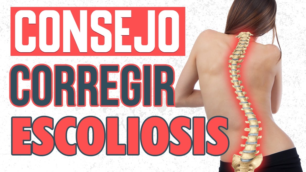 Remedios caseros para escoliosis lumbar