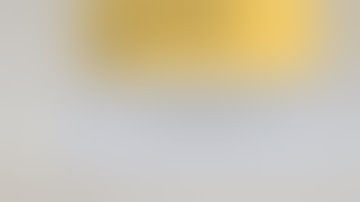 CASE 30  IVUS Guided Sting Ray Re-Entry for Circumflex CTO