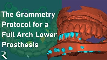 Grammetry and the CombiGuide: Protocol for a Full Arch Lower Prosthesis