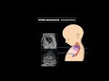 Fetal Echocardiography: Protocol and Technique