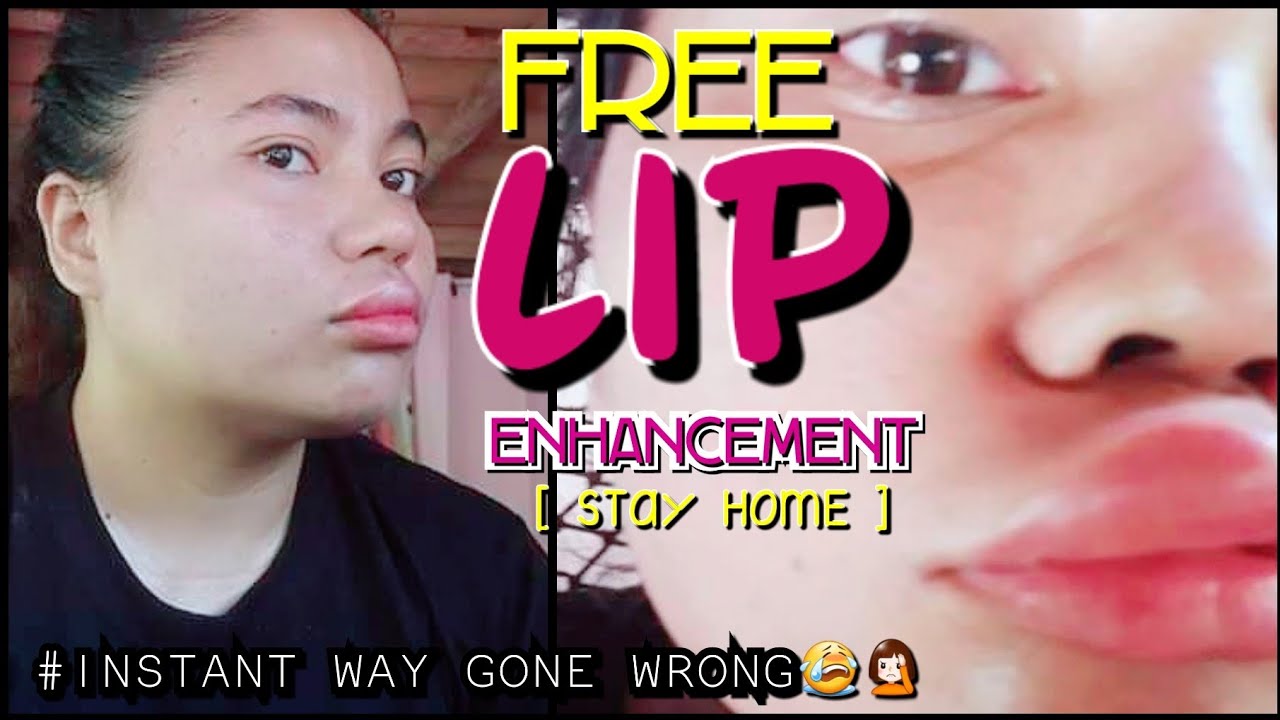 FREE LIP ENHANCEMENT GONE WRONG 2020 YouTube