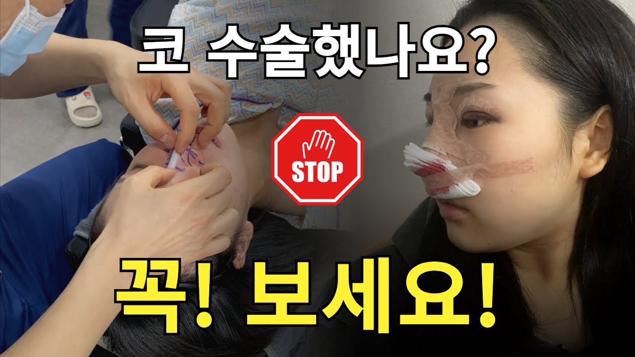 [Вандерфул гоо сайхны мэс засал] [ЧУХАЛ] Хамарны мэс засал хийлгэсэн бол заавал үзэх ёстой!!! l Хамарны мэс заслын дараах анхаарах зүйлс (feat. CLOVA Dubbing)