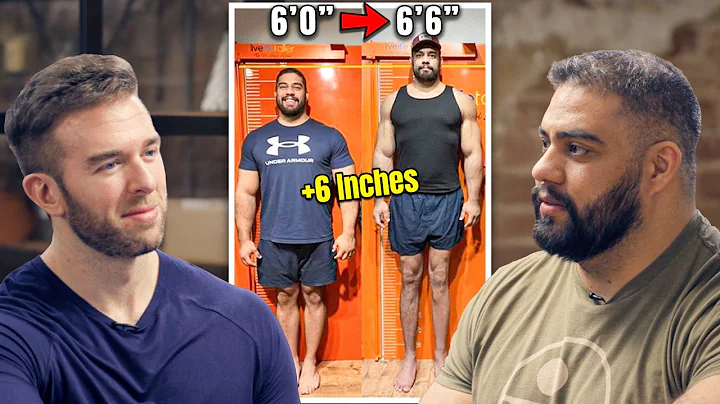 This Should Be IMPOSSIBLE - 365lb Man GREW 6 INCHES!? | Brian Sanchez’s Limb Lengthening Surgeries