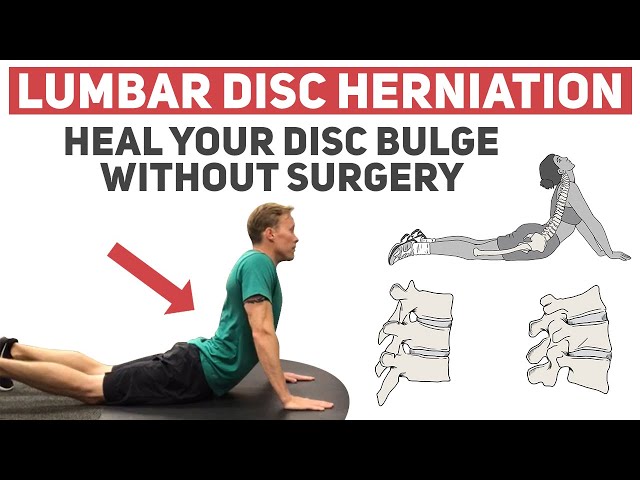 When do you know it's time for herniated disc surgery?