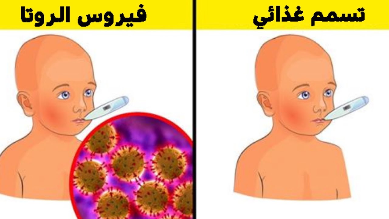 Ротавирус отличить. Ротавирусная инфекция. Ротовирус или отравление. Как отличить ротавирус от отравления. Ротавирус картинки.