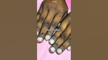 Dark Knuckles? Do This Every Night #shorts #888 #darkknuckles #beauty #kpop #youtubeshorts #selfcare