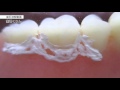 義歯洗浄剤「フィジオクリーン歯石くりん」歯石溶解動画