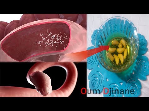 فيديو: داء الديدان الطفيلية للثوم