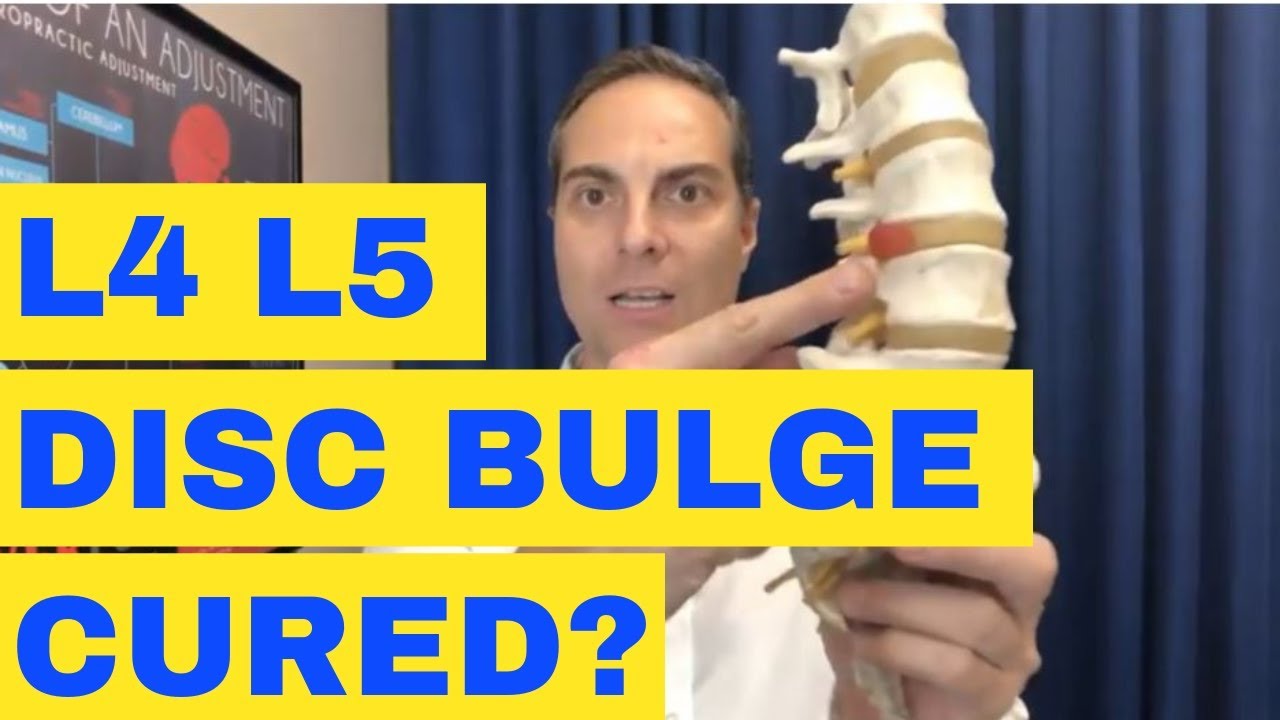 L4 L5 Disc Bulge Cured? Can L4L5 Disc Bulge Cure With Treatment