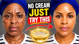 No Cream. No Serum. Just Thisโฆ My Skin Changed Overnight No Cream. No Serum. Just Thisโฆ My Skin Changed Overnight