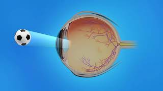 Age-Related Macular Degeneration (AMD): Types, Causes, Symptoms, Treatment