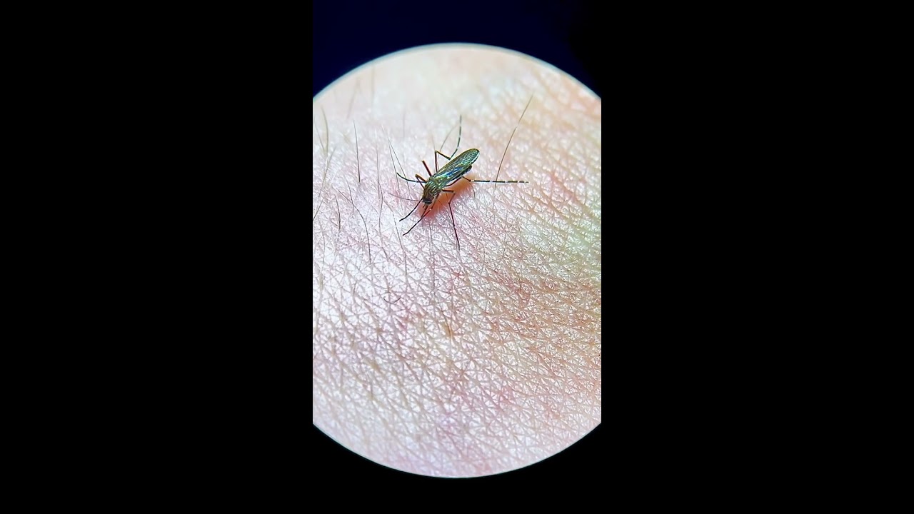 Mosquito Bites My Hand Live Under The Microscope 
