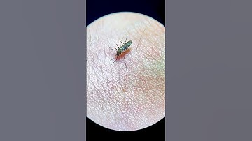 Mosquito bites my hand live under the microscope!