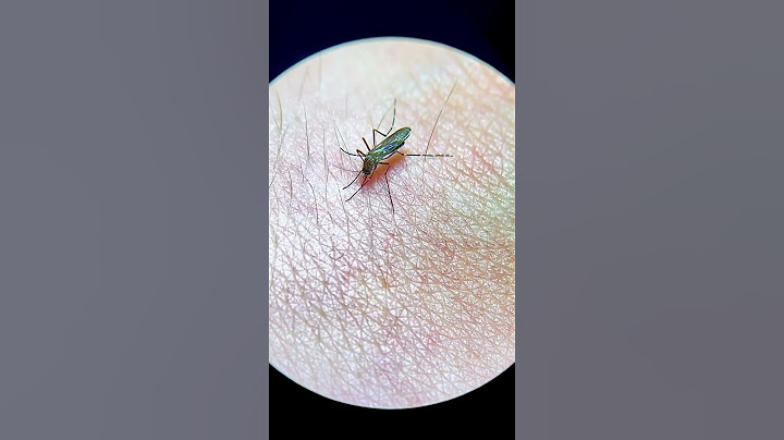 Mosquito bites my hand live under the microscope!