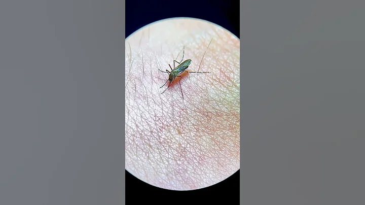 Mosquito bites my hand live under the microscope! - DayDayNews