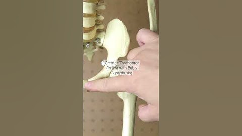Intramuscular Injection - Ventrogluteal Muscle (Skeleton Edition)