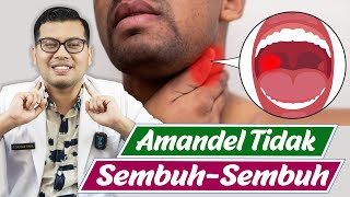 RADANG AMANDEL TAK KUNJUNG SEMBUH (TONSILITIS KRONIS) - DOKTER SADDAM ISMAIL