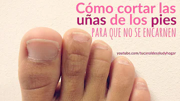 ¿Cómo se recortan las uñas de los pies para evitar que se encarnen?