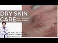 Best Dry Skin Care Treatment Home Remedies In Hindi, Dermatologist | Moisturizer & Facewash Dry Skin