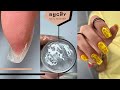 SUPER Active Hyponychium 😳 ONE MONTH Old Nails Transformation