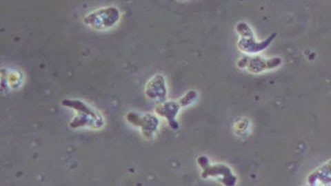 Naegleria fowleri under a microscope with increased speed.