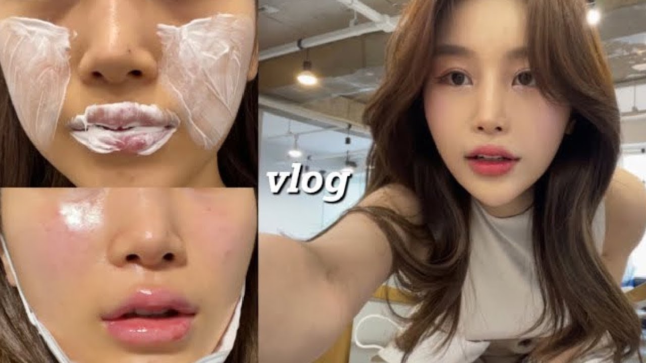 韓国olのvlog 唇と涙袋にヒアルロン酸を入れてみた Youtube