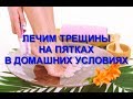 Лечим трещины на пятках 5 Суперэффективных метода народное лечение