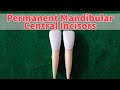 Permanent Mandibular Central Incisor