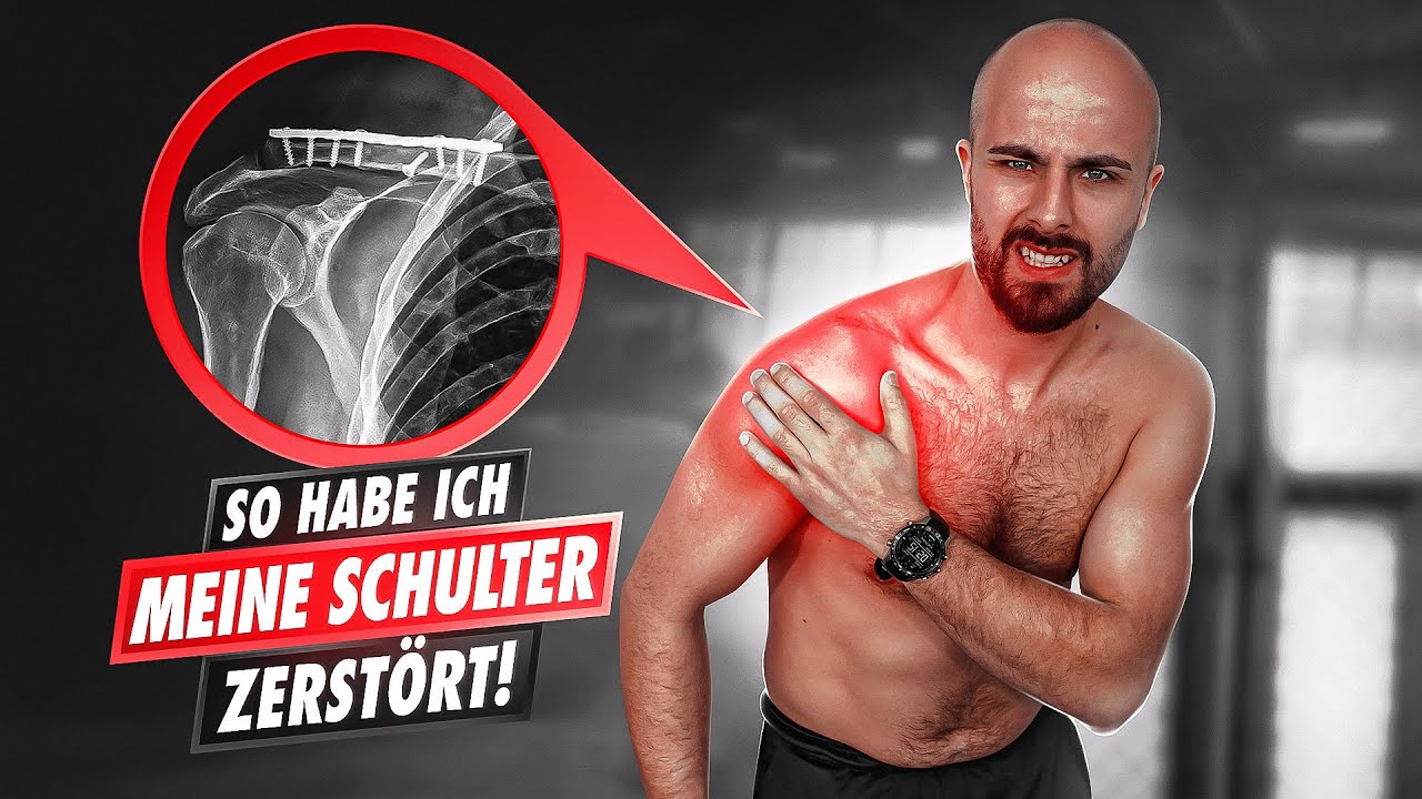 Schulter: schmerzfrei - beweglicher - stärker