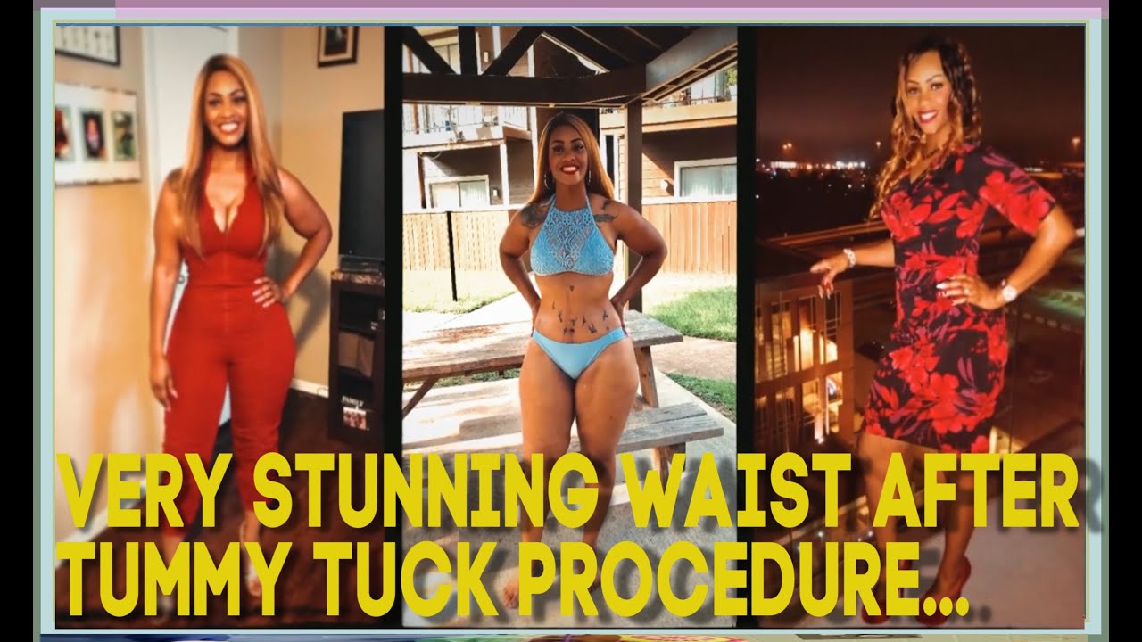 houston zoo Happy and Confident With Her Stunning Body After Tummy Tuck Procedure | Dr. Cortes | Plastic Surgery