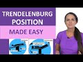 Understanding Trendelenburg Positions