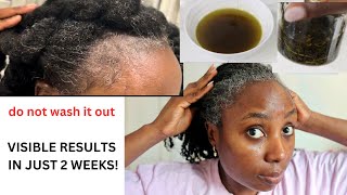 Your Hair Will Be Too Thick To Handle Just After 2 Weeks Of Using This Oil! Grow Your Bald Spots