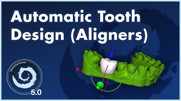 BSPV5.0 Missing Tooth in Aligner Case? No Problem! Automatic Missing Tooth Design in Aligner Flow!