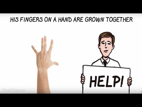 Video: Webbing Of The Fingers: Penyebab Dan Perawatan
