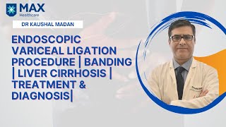 Endoscopic Variceal Ligation Procedure| Banding| Liver Cirrhosis| Treatment & Diagnosis| Dr Kaushal