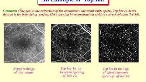 Mathematical Morphology II: Filtering