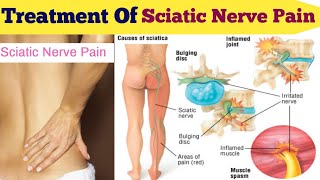 साइटिका के दर्द का गारंटीड इलाज !Best Treatment of Sciatic Nerve Pain.#sciatic back pain #medicine