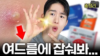 여드름 탈출 n년차, 꾸준히 챙겨 먹는 영양제들