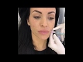 Cara Kilby visits Natali Kelly to get her Glow Back - Volite Skin Boosting Treatment